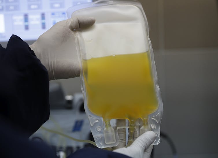 Gloved hands holding up an IV bag filled with yellow fluid