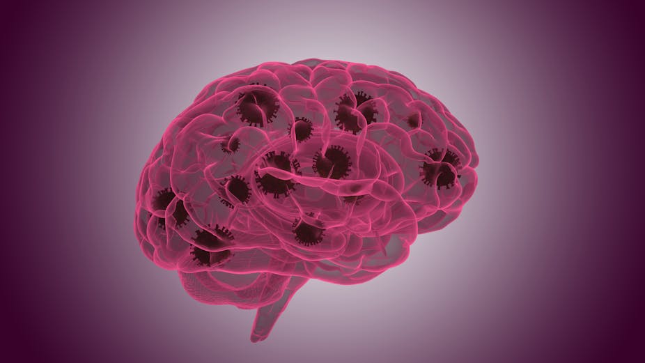 A pink illustration of a brain with virus particles throughout.