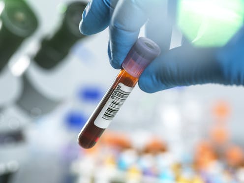 A blood test that screens for multiple cancers at once promises to boost early detection