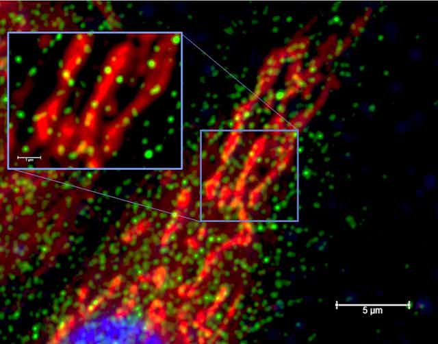 Red rod-like shapes speckled with green dots against a black background. Scale indicates a scale of five nanometers.