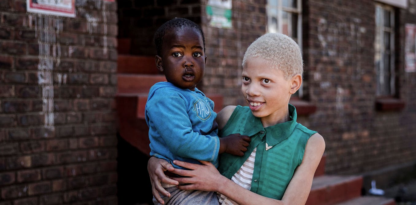 Being light-skinned can lead to 'reverse colorism' in many parts of the ...