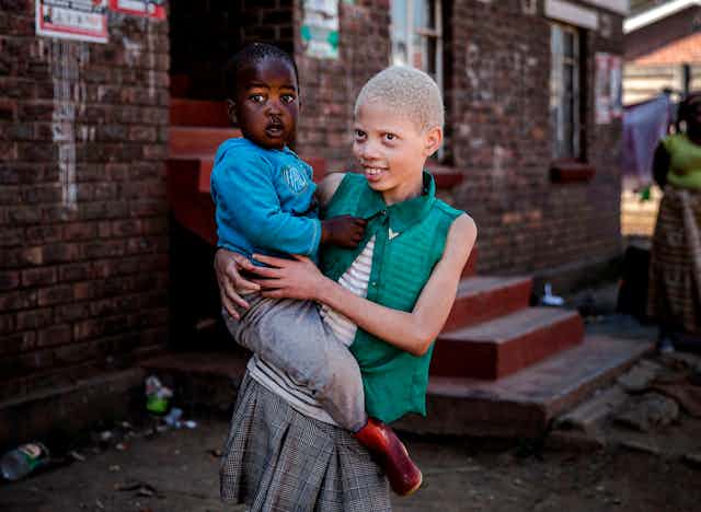 Albino girl carries a member of her family in Zimbabwe.