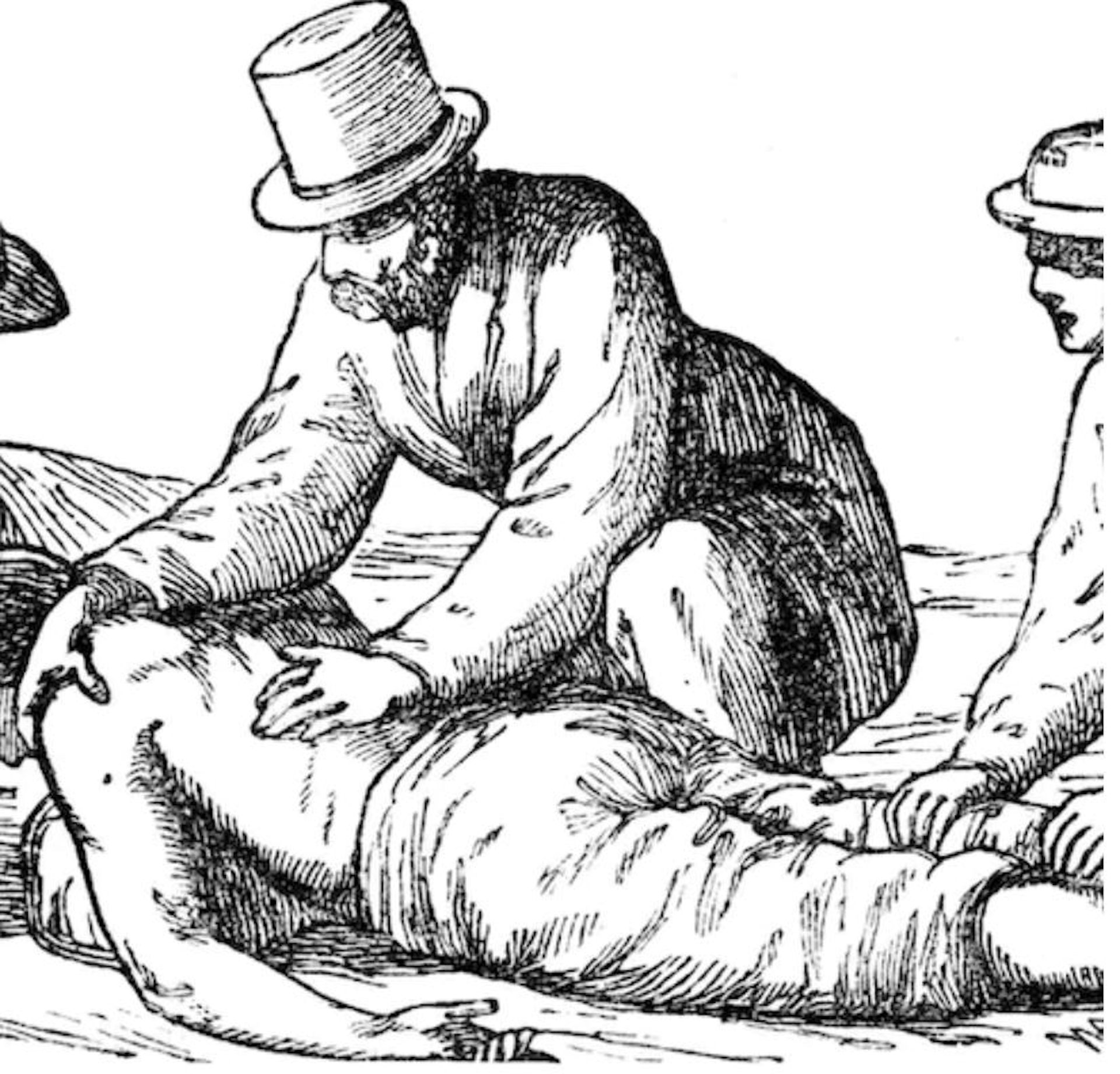 Mengakali kematian: sejarah aneh praktik resusitasi