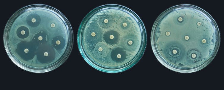 Three petri dishes arranged side by side.
