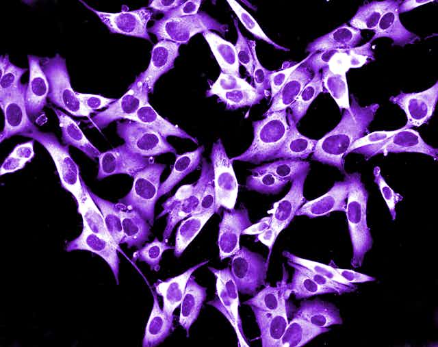 Close-up of purple melanoma cells growing in culture