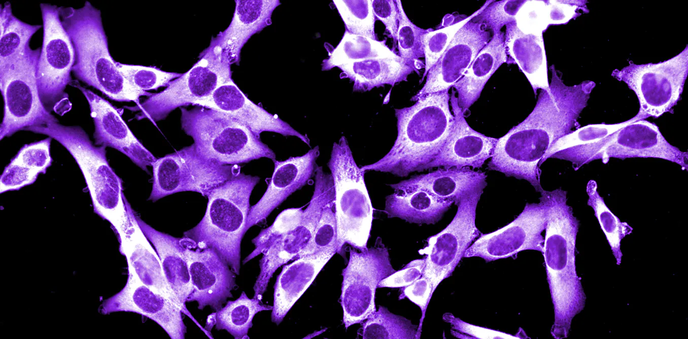 Cancer Cell Vs Normal Cell Microscope