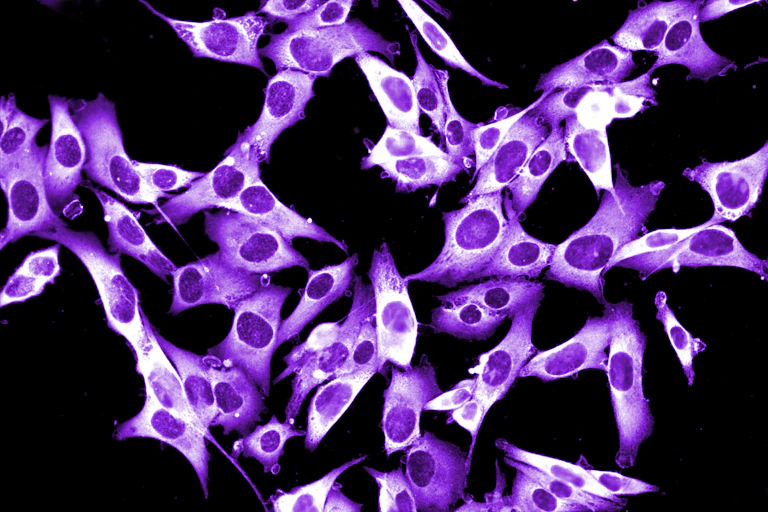 Close-up of purple melanoma cells growing in culture