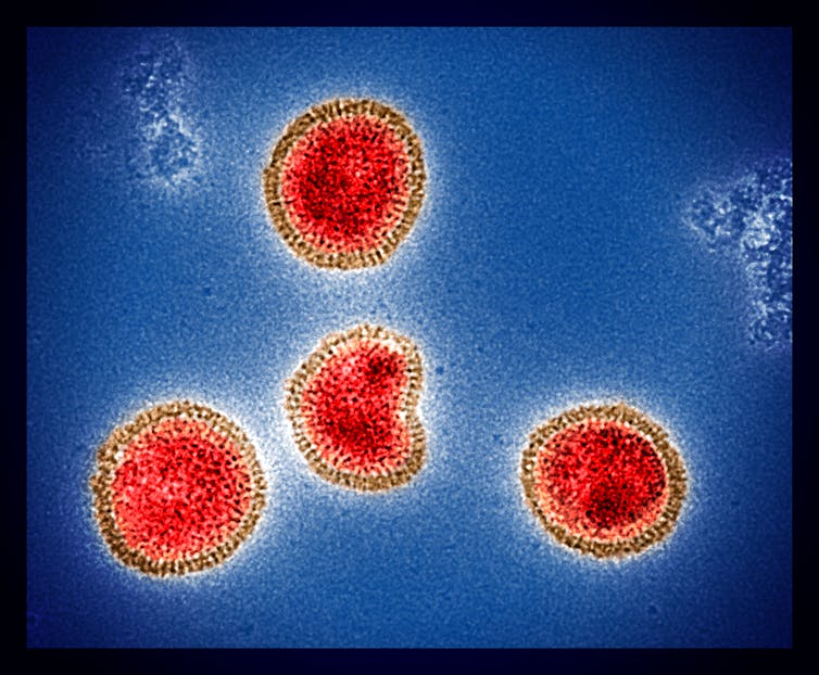 Quatre taches circulaires rouges sur un fond bleu