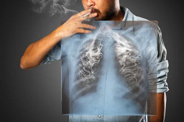 Hombre fumando con una radiografía delante de su pecho que muestra los pulmones llenos de humo.