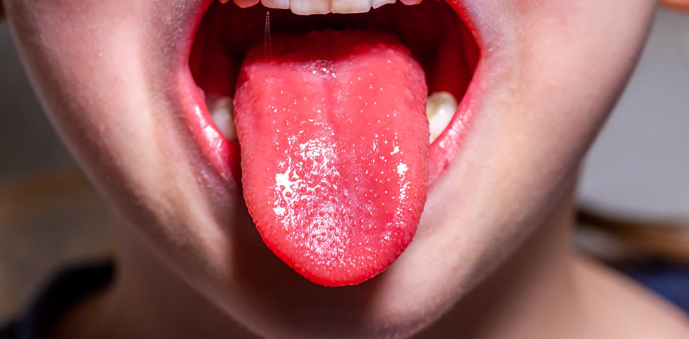 لسان الفراولة