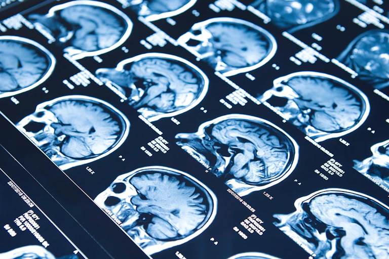 X-rays of the brain.