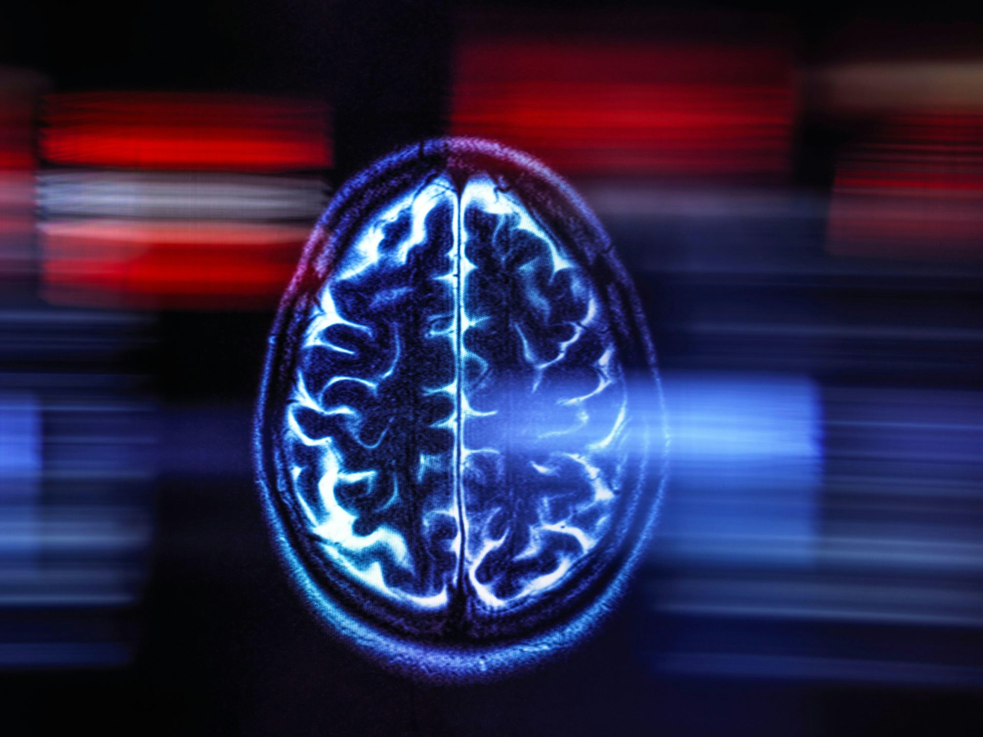 An image of a brain scan.