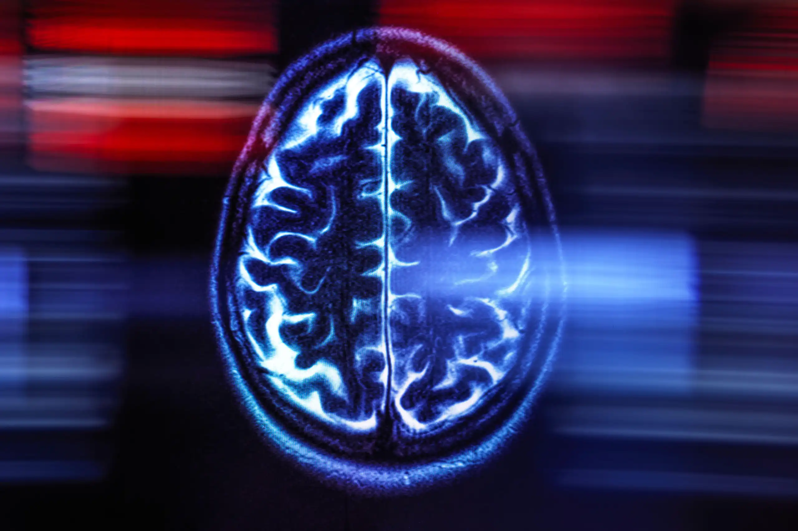 An image of a brain scan.
