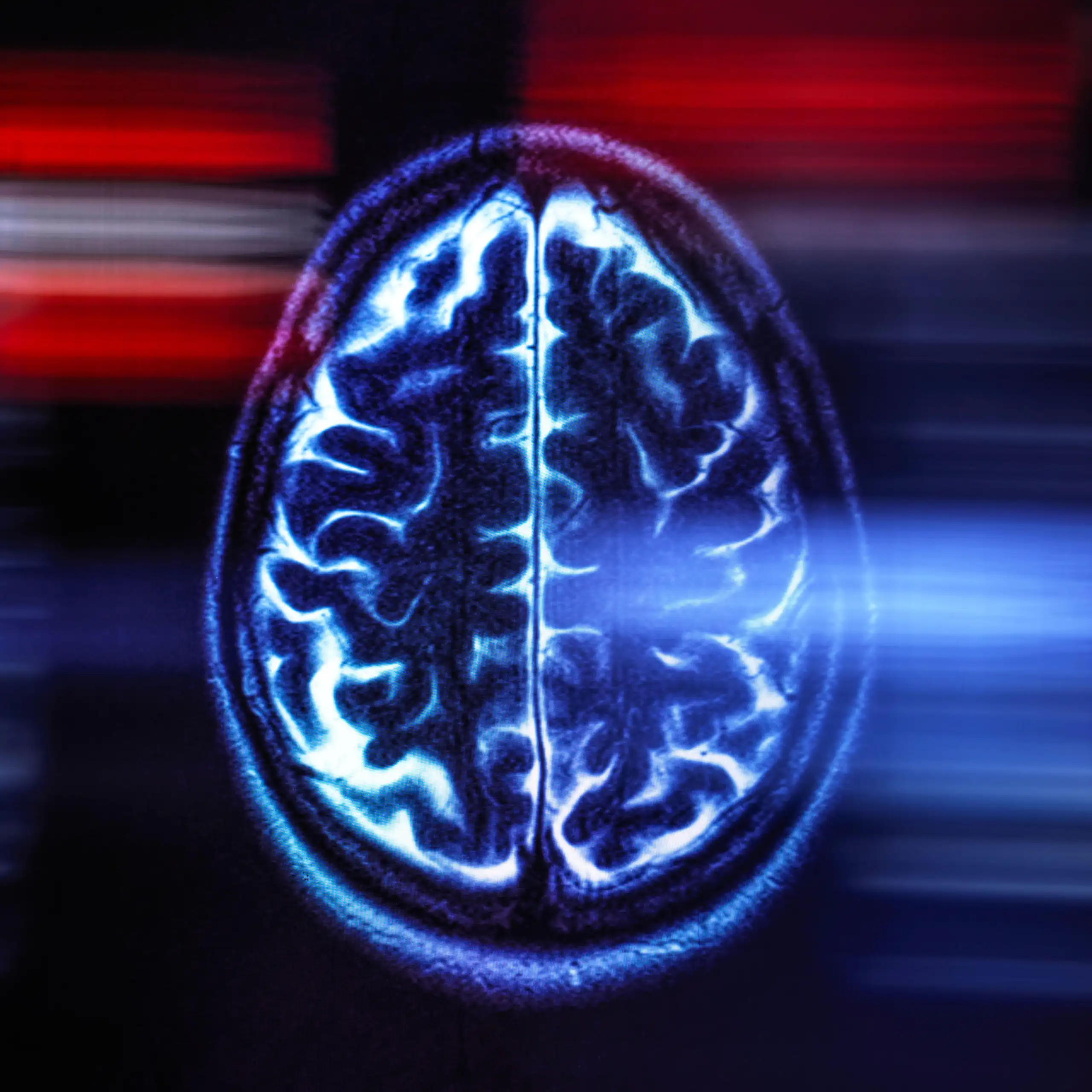 An image of a brain scan.