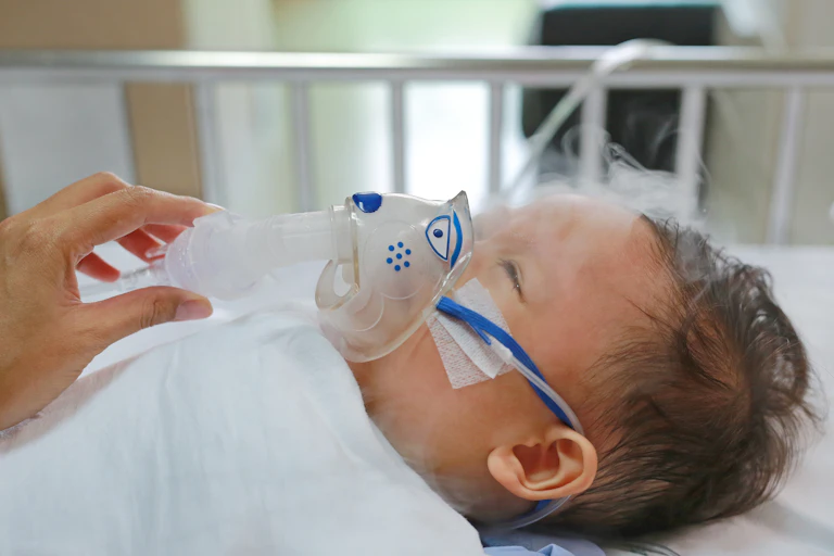 A toddler boy lies on his back with a nebulizer over his nose and mouth and mist rising from the inhaler.