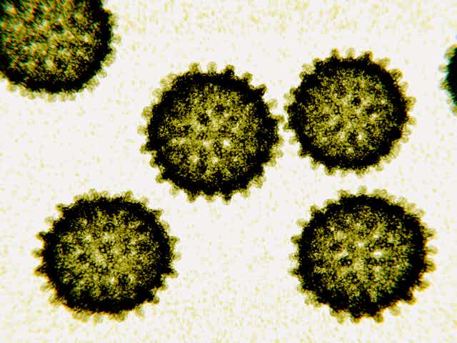 Microscopy image of hepatitis C virus particles