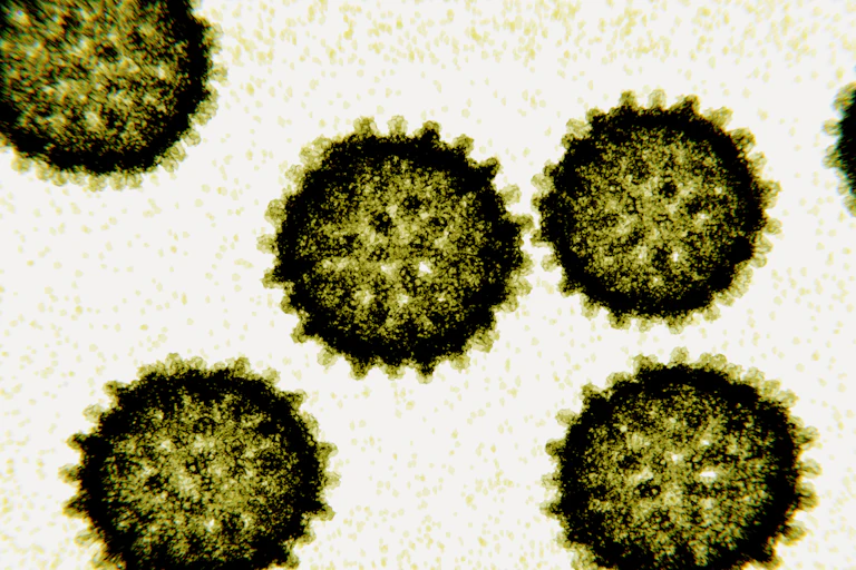 Microscopy image of hepatitis C virus particles