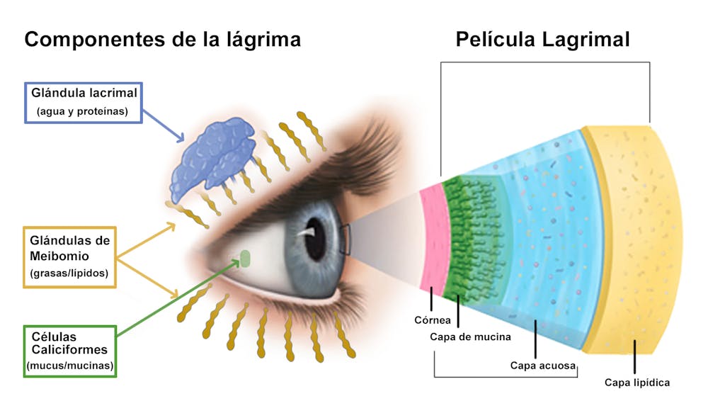 Tratamiento del ojo seco (III): lágrimas artificiales - Ocularis