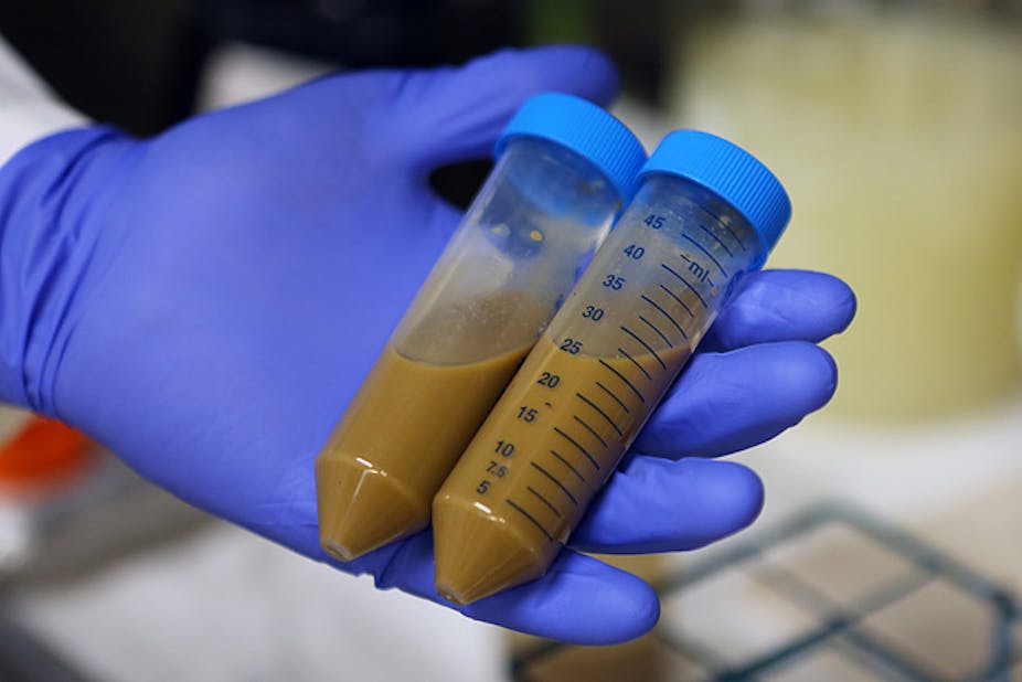 Faecal Transplants Not The First Prescription Of Medicinal Poo