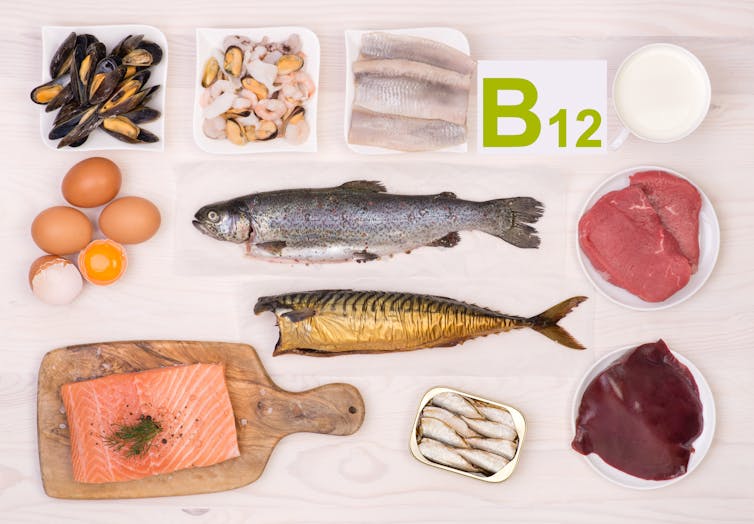 Uma tomada aérea de uma variedade de alimentos contendo B12, incluindo ostras, peixe, ovos, carne vermelha e muito mais.
