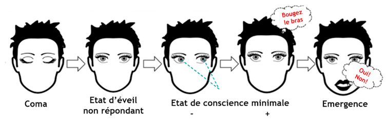 Chaque état se distingue par des capacités différentes : ouverture des yeux, réponses aux questions, etc