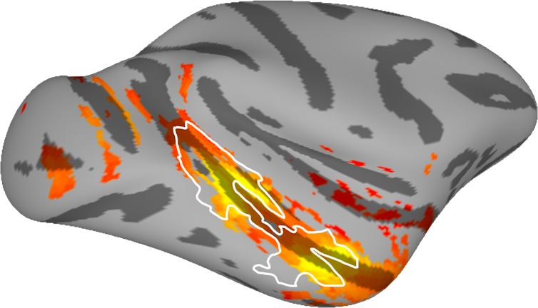 A brain scan showing activity in yellow and red and an active area outlined in white.