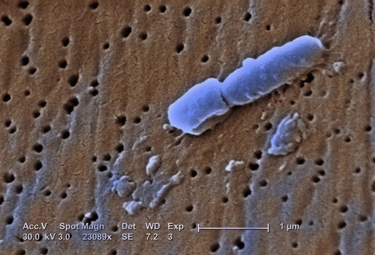 A Klebsiella pneumoniae bacterium.