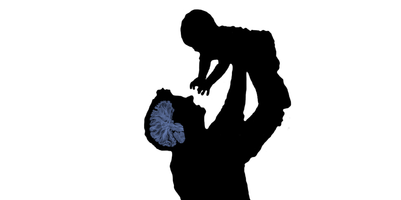 Fatherhood changes men’s brains, according to before-and-after MRIscans