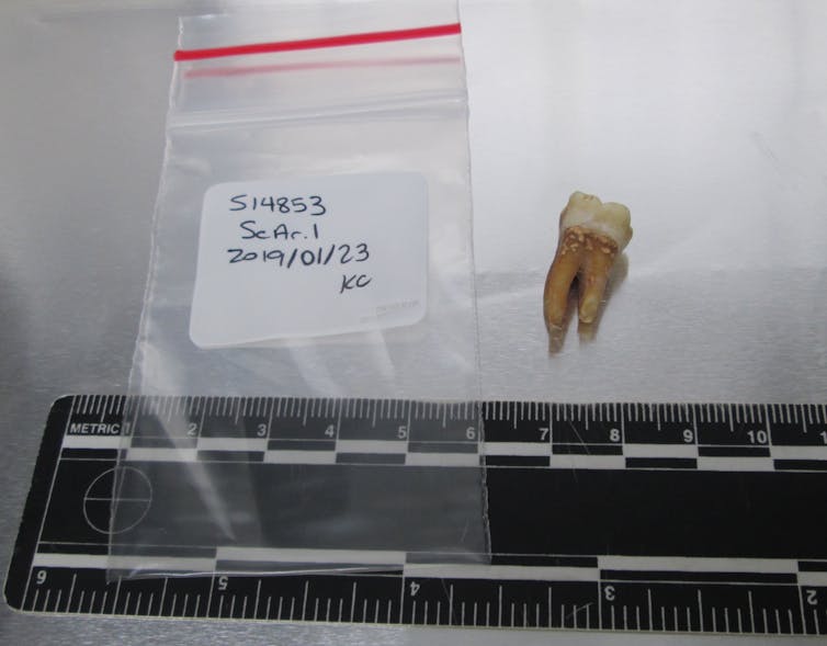 tooth next to ruler and labelled plastic bag