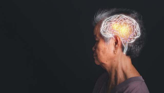 femme d'origine asiatique de profil avec un schéma de cerveau sur le côté de sa tête