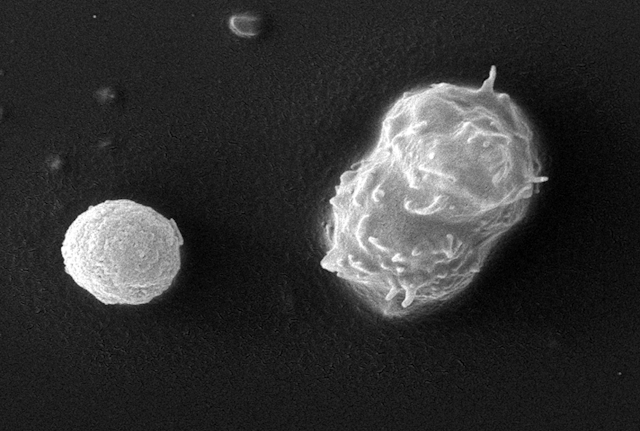 Image de microscopie électronique à balayage de deux amibes, l’une au stade kystique, l’autre au stade trophozoïte.