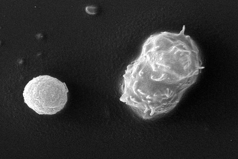 Image de microscopie électronique à balayage de deux amibes, l’une au stade kystique, l’autre au stade trophozoïte.