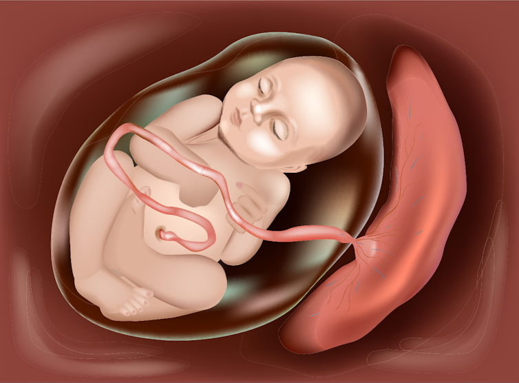 Fetus and placenta in a uterus