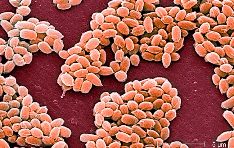 Spores de B. anthracis
