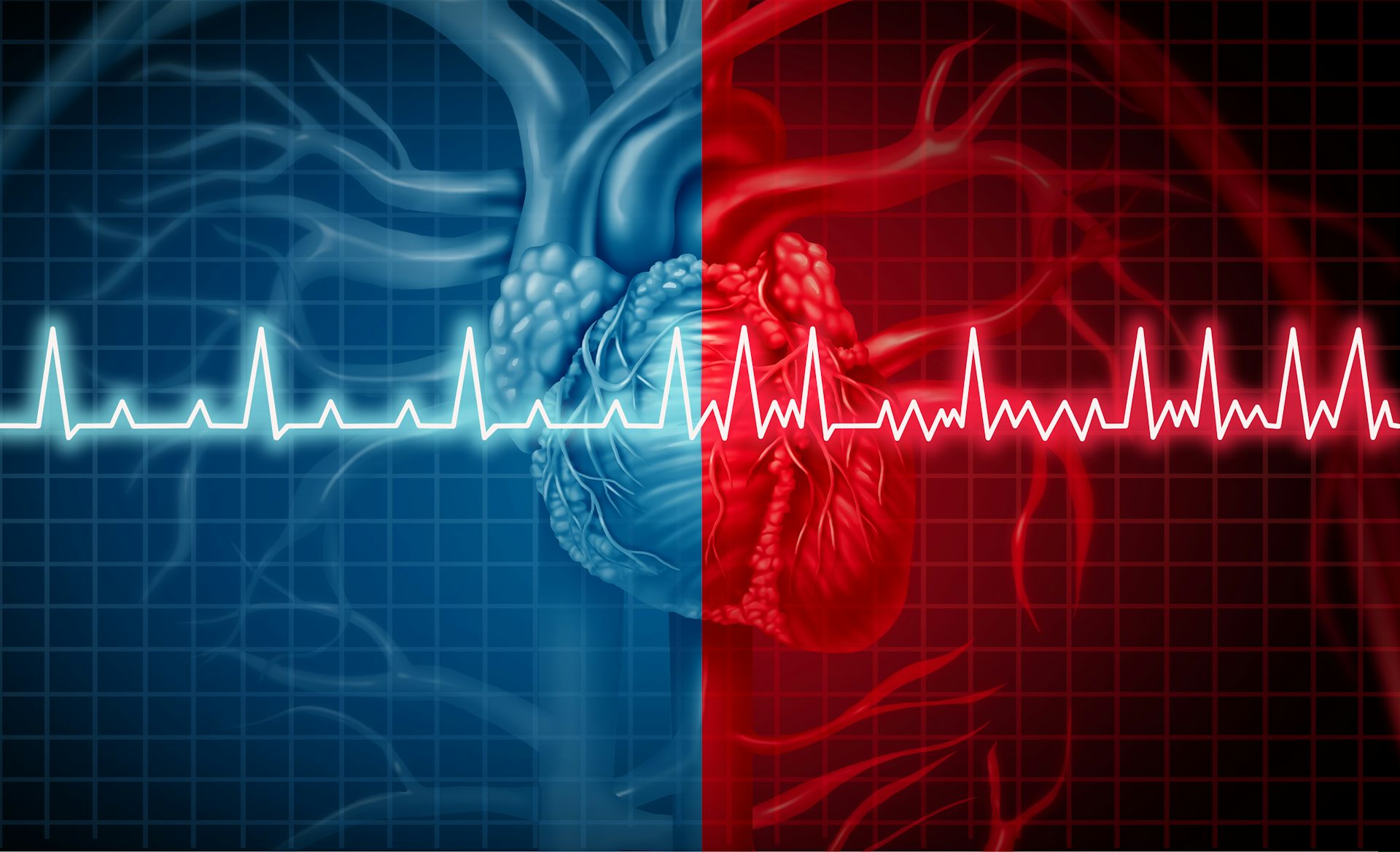 in-search-of-the-origin-of-cardiac-arrhythmias