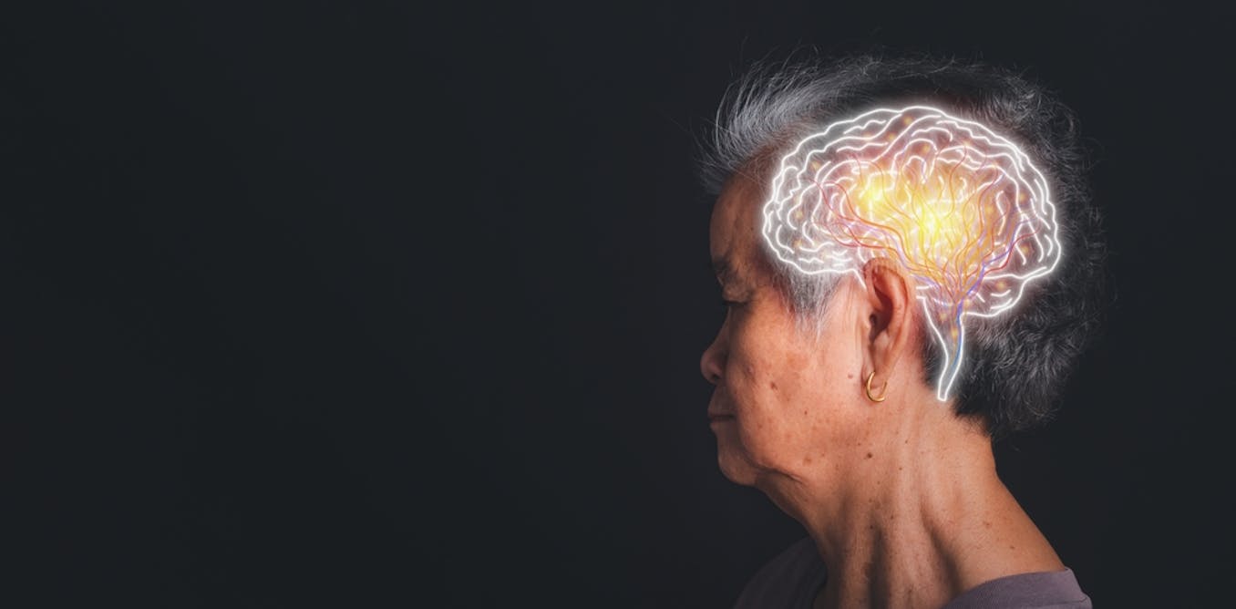 Why does the Alzheimer’s brain become insulin-resistant?