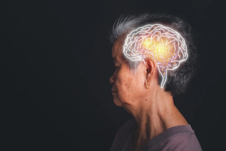Asian woman in profile with a brain pattern on the side of her head