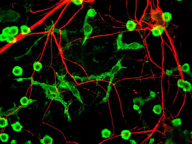 Microscopy image of microglia and neuritis 