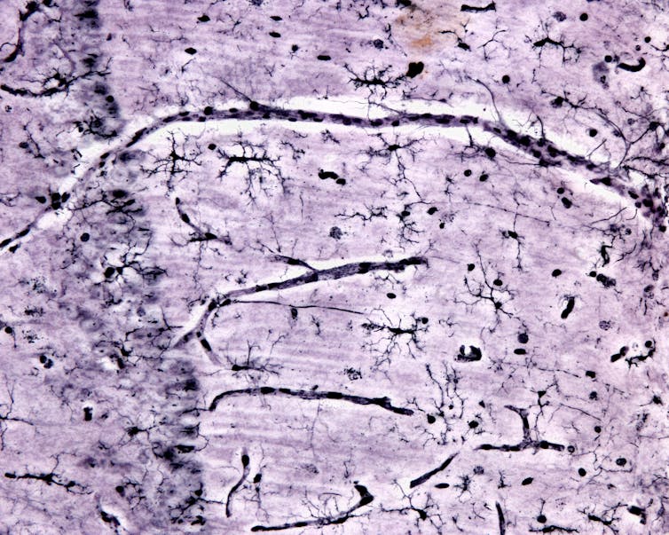 Light micrograph of microglia cells