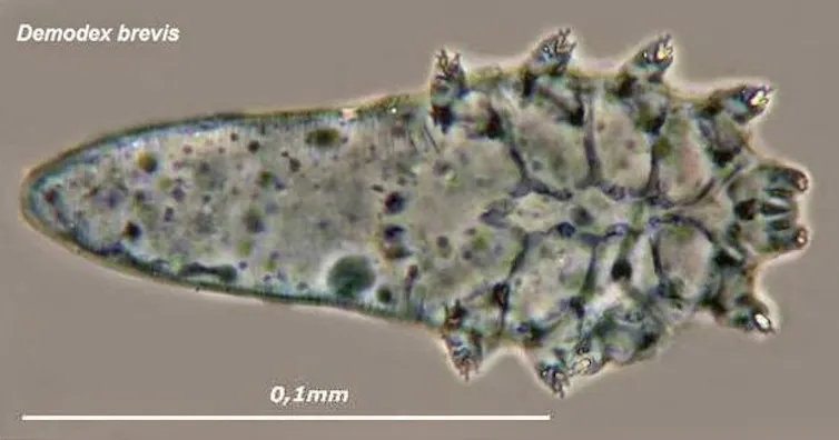 A spotty, translucent looking organism with eight legs concentrated on one end