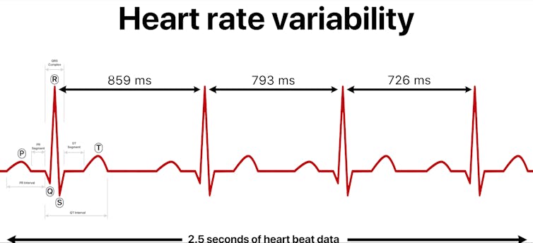 Scheme of the red peaks of the heartbeat at slightly different intervals
