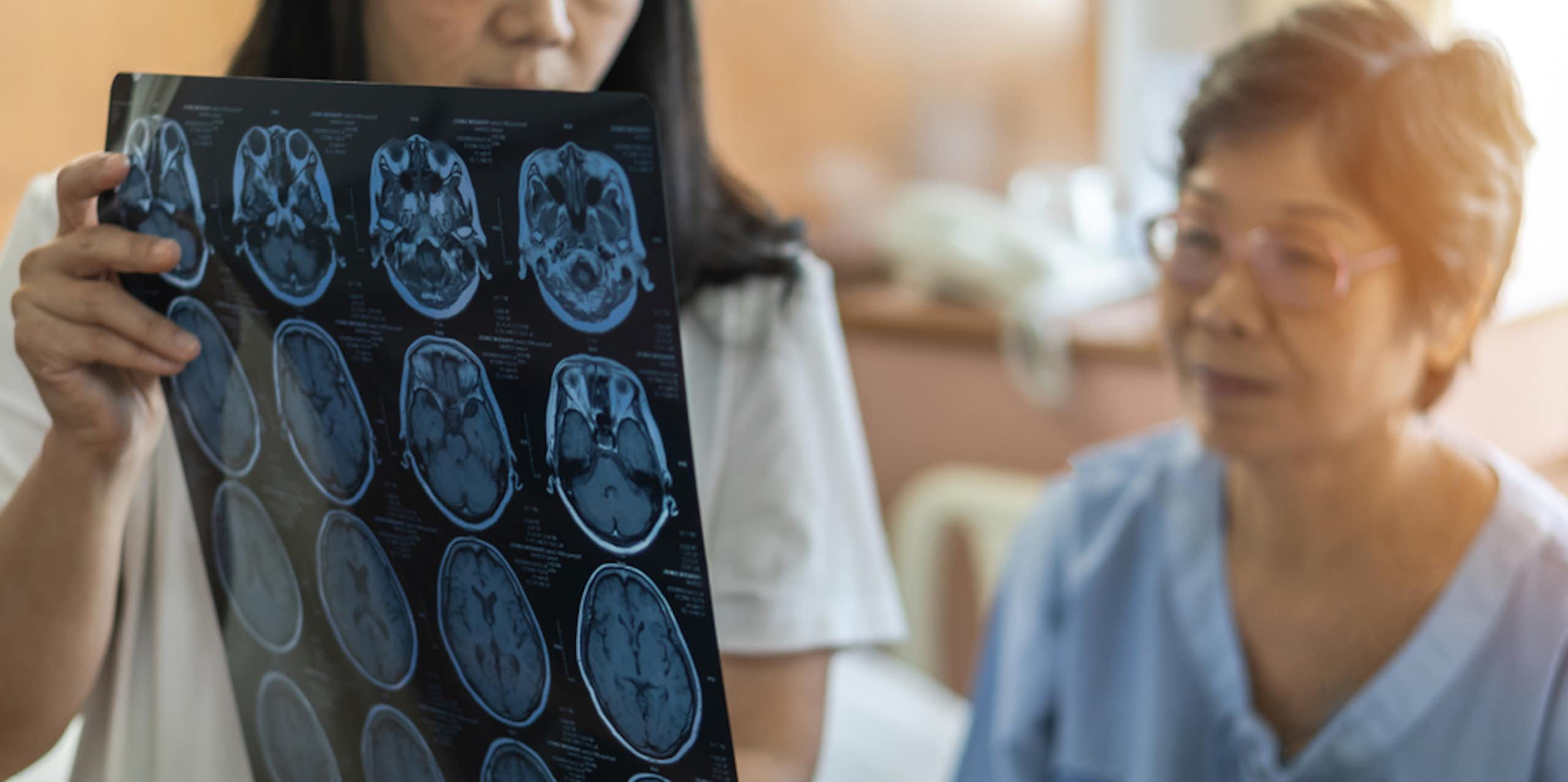 femme montre à une patiente des images de son cerveau