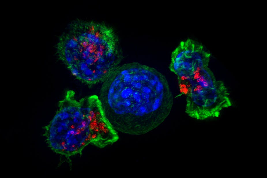 Microscopy image of killer T cells surrounding a cancer cell