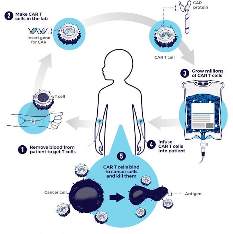 Digram of CAR-T therapy process