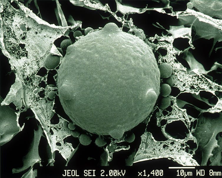 Scanning electron micrograph of chytrid fungus