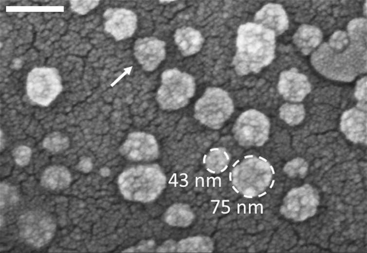 Electron micrograph of exosomes on a surface