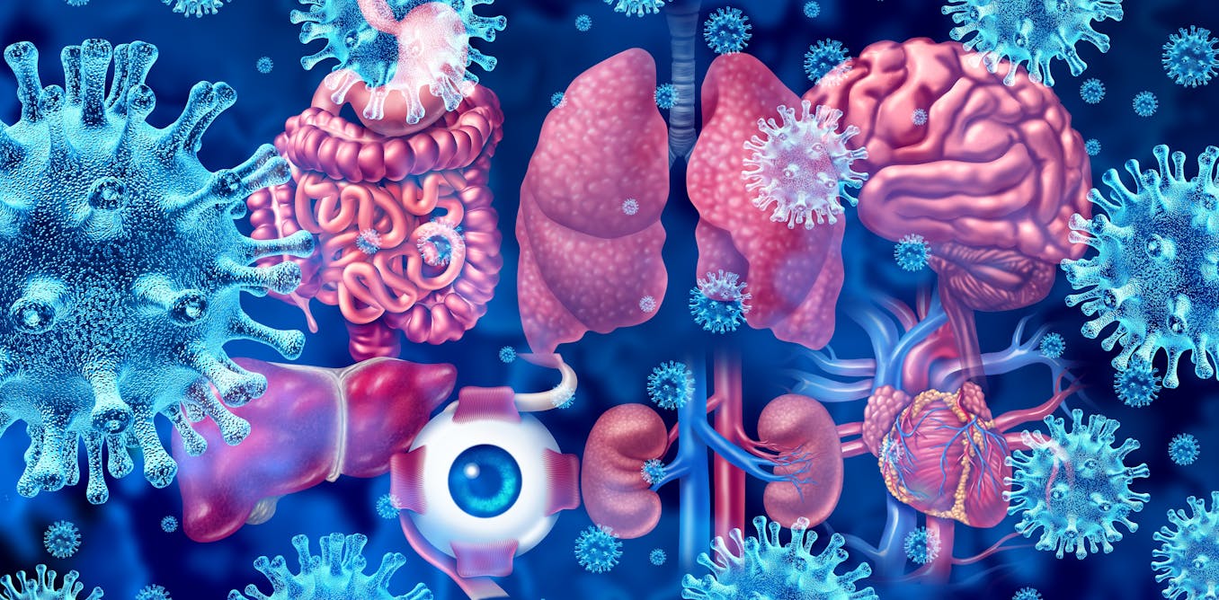 Covid persistente: por qué contagiarse tiene más consecuencias de lo que parece