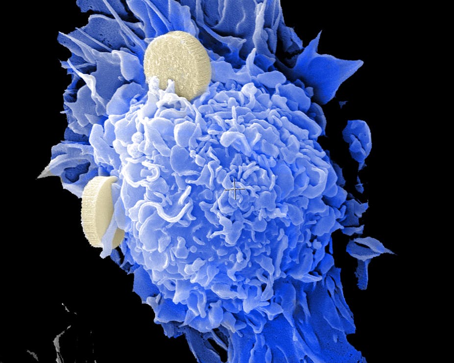 Microscopy image of dendritic cells interacting with nano-vaccines 