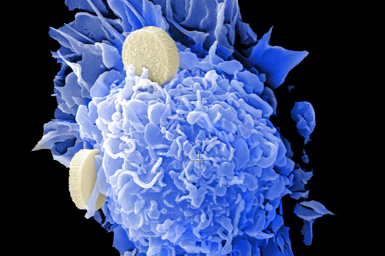 Microscopy image of dendritic cells interacting with nano-vaccines