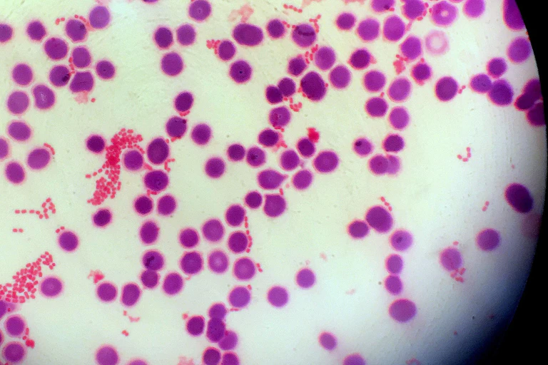 Microscopy image of gram negative bacteria and blood cells